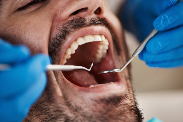 Best Emergency Wisdom Teeth Removal in Homer City, PA